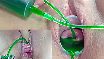 Japanese Lesbian Couple Explores Kinky Gynecological Play With Injections And Squirting